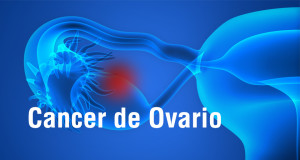 Cancer_ovario