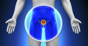 centro-urologico-biopsia-prostatica