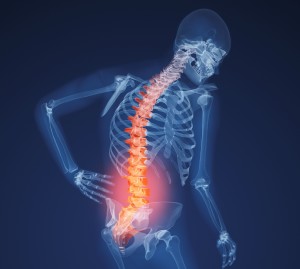x-ray-lower-back-031611_cropped