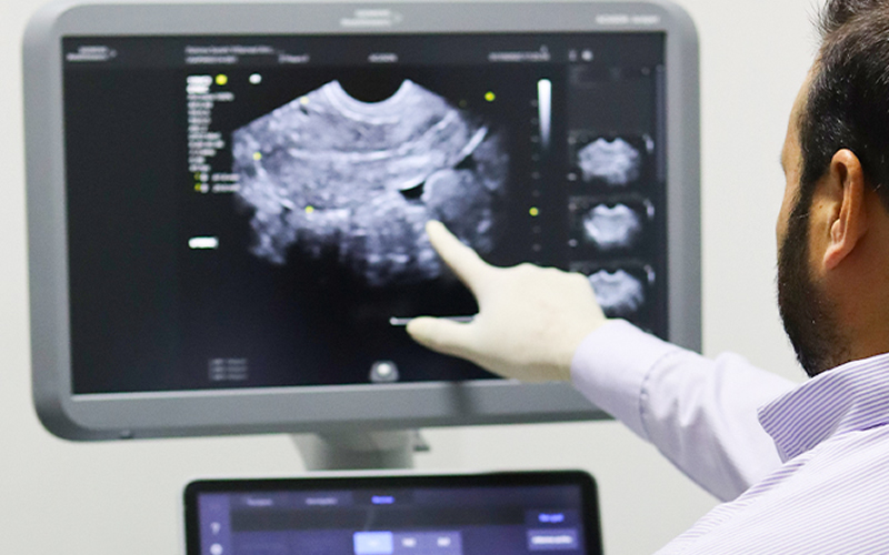 Ultrasonido Ultrasonido